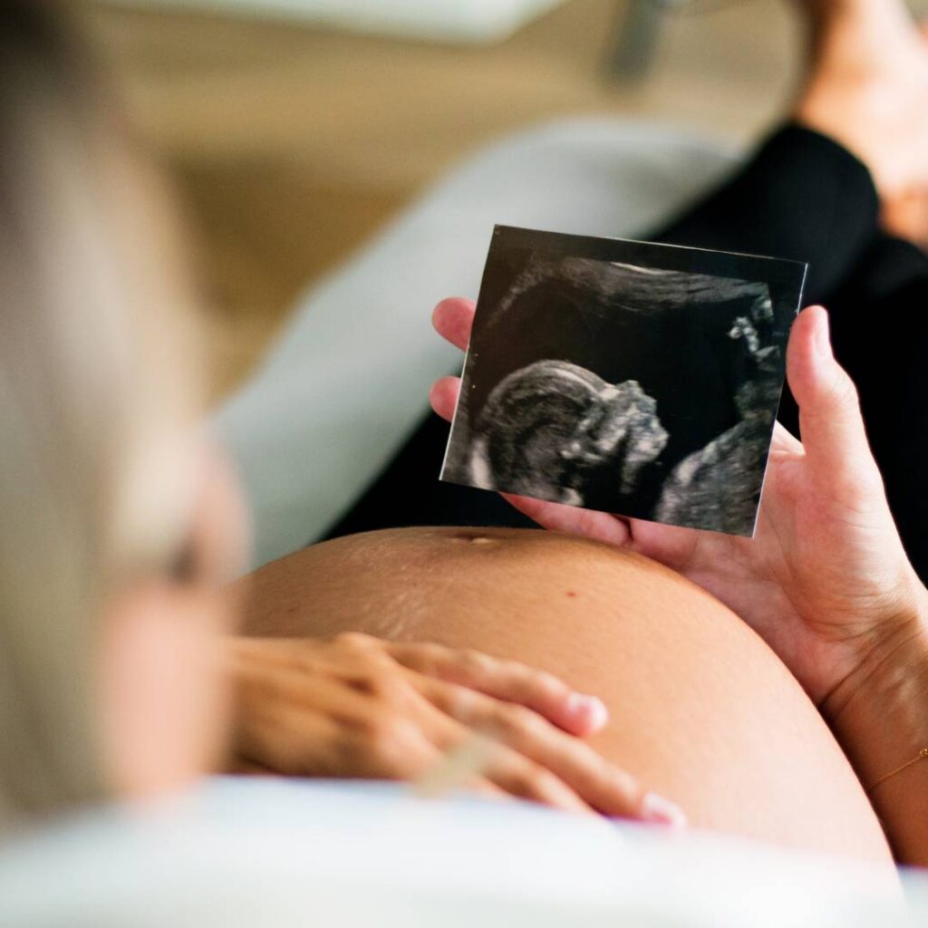 pregnant woman with ultrasound image